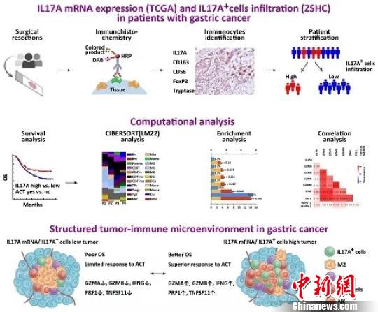 中國科學家發現胃癌微環境抗腫瘤免疫機制